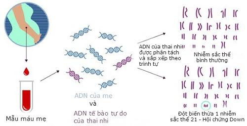 Máu mẹ tiết lộ bí mật thai nhi