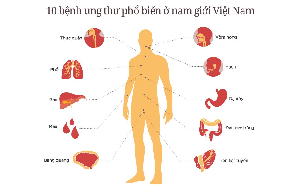 Tỷ lệ đàn ông Việt Nam chết vì ung thư thuộc loại cao nhất thế giới