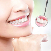 Những điều ít biết về răng