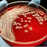 Khi kháng sinh trở nên vô dụng, số người chết vì vi khuẩn sẽ nhiều hơn ung thư