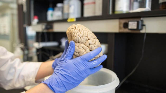 Các nhà khoa học tìm ra con đường ngăn chặn hoàn toàn ung thư não