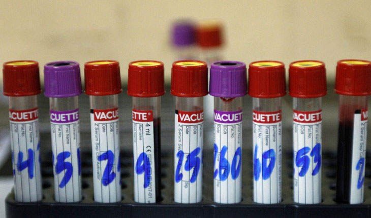 Mỹ phát hiện ca tử vong do virus Zika đầu tiên