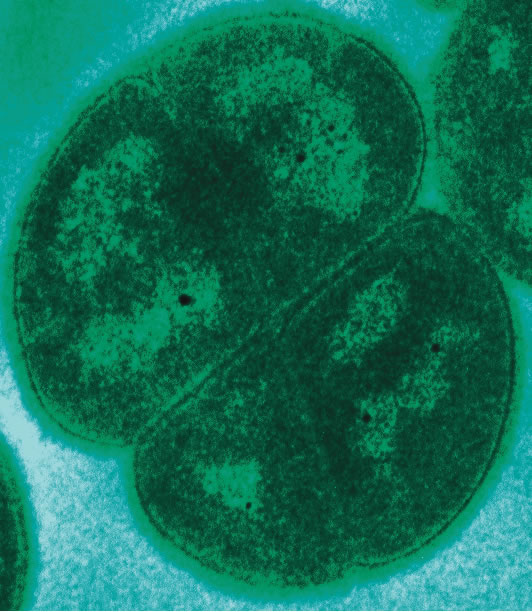 Vi khuẩn Deinococcus Radioduran
