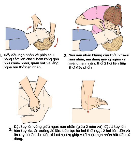Cách cứu người bị ngạt nước