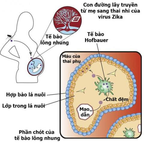 Đã tìm ra con đường Zika lây truyền từ mẹ sang con
