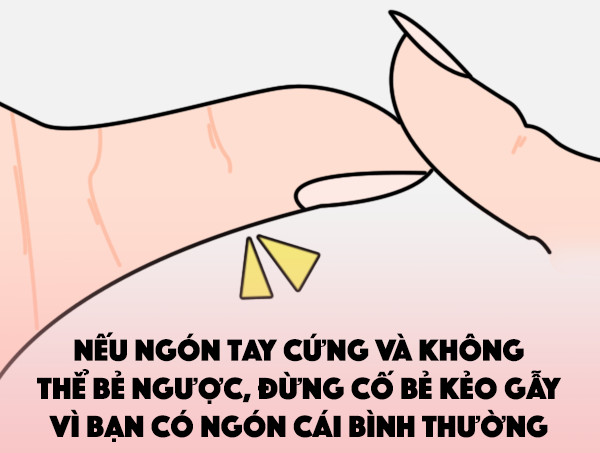 Những điều ít biết về người có ngón tay cái bẻ ngược