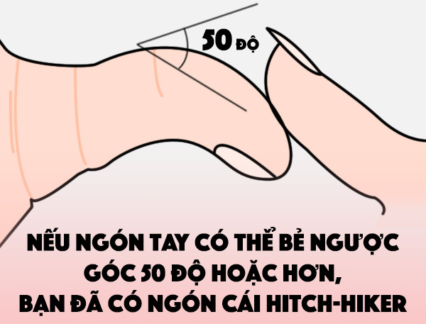 Những điều ít biết về người có ngón tay cái bẻ ngược