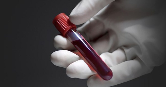 Tìm ra phương pháp xét nghiệm ung thư an toàn nhất từ trước đến nay