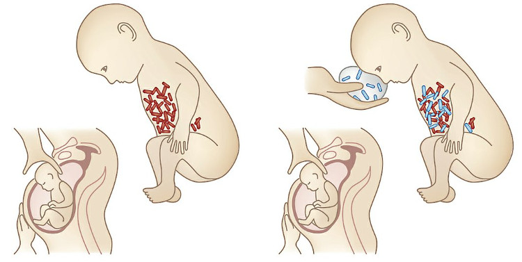 Kháng sinh ảnh hưởng nghiêm trọng đến sự phát triển của trẻ nhỏ