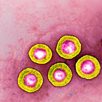 Sắp có vắc xin ngừa virus herpes gây bệnh tình dục