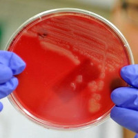 Phát hiện thêm ca nhiễm siêu vi khuẩn kháng mọi kháng sinh ở Mỹ