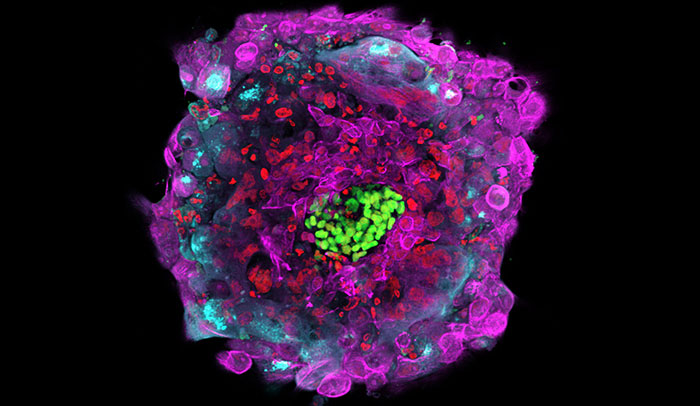 Hôn nhau có thể làm lây nhiễm virus gây vô sinh?