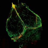 Phát hiện mạch bạch huyết chưa từng thấy trong não người