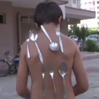 Cậu bé 9 tuổi biến thành "cục nam châm" mỗi khi tức giận