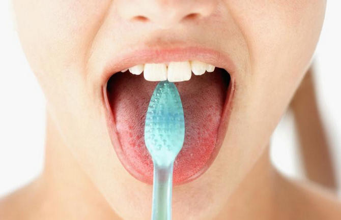 Vì sao bạn nên cạo lưỡi hàng ngày?