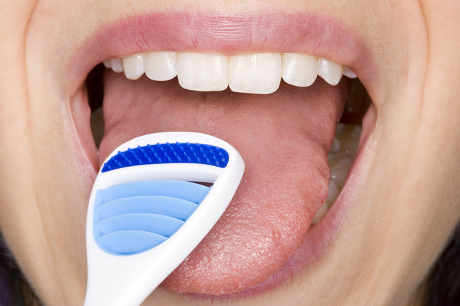 Vì sao bạn nên cạo lưỡi hàng ngày?