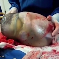 Video: Khoảnh khắc hiếm gặp khi bé sơ sinh chào đời trong màng ối