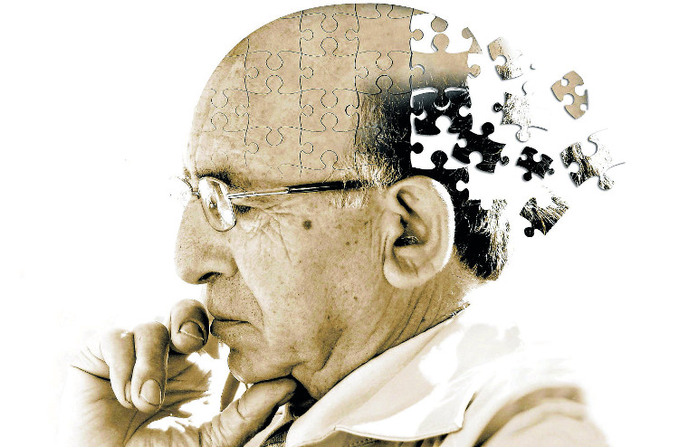 Các nhà khoa học phải mất 15 năm hoặc lâu hơn nữa mới có thể tạo ra được loại thuốc điều trị chứng mất trí nhớ ở người.