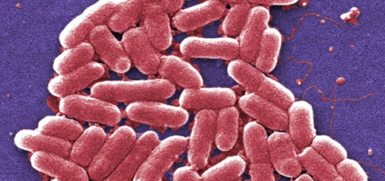 Chuỗi siêu khuẩn E. coli kháng được hai loại kháng sinh dự phòng cuối cùng đã được tìm thấy tại Mỹ. Chuỗi siêu khuẩn E. coli kháng được hai loại kháng sinh dự phòng cuối cùng đã được tìm thấy tại Mỹ.