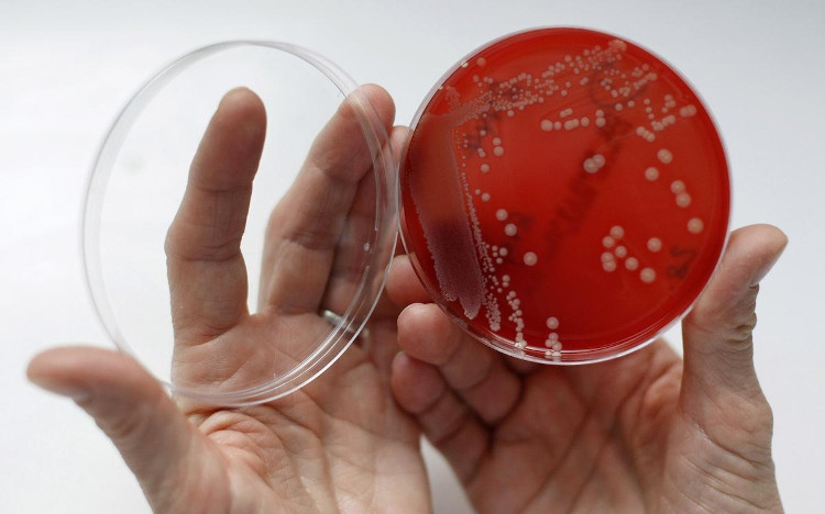 Hi vọng vẫn luôn tồn tại trong cuộc chiến với siêu vi khuẩn kháng kháng sinh của nhân loại.