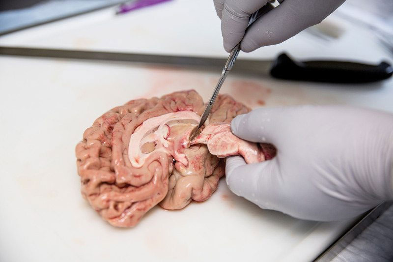 Sau khi cân, bộ não được chia thành hai nửa và nhúng vào dung dịch muối tiệt trùng.