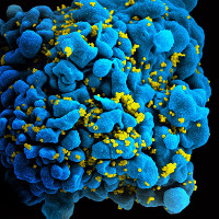 Người đàn ông Anh có thể là người đầu tiên được chữa khỏi HIV nhờ liệu pháp mới