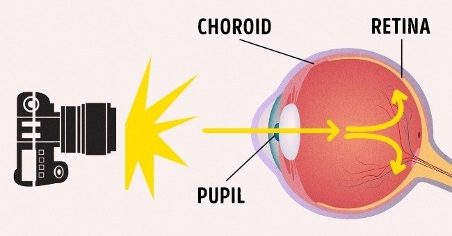 Tại sao khi chụp ảnh mắt của bạn lại "đỏ quạch" trông như "ma cà rồng"?