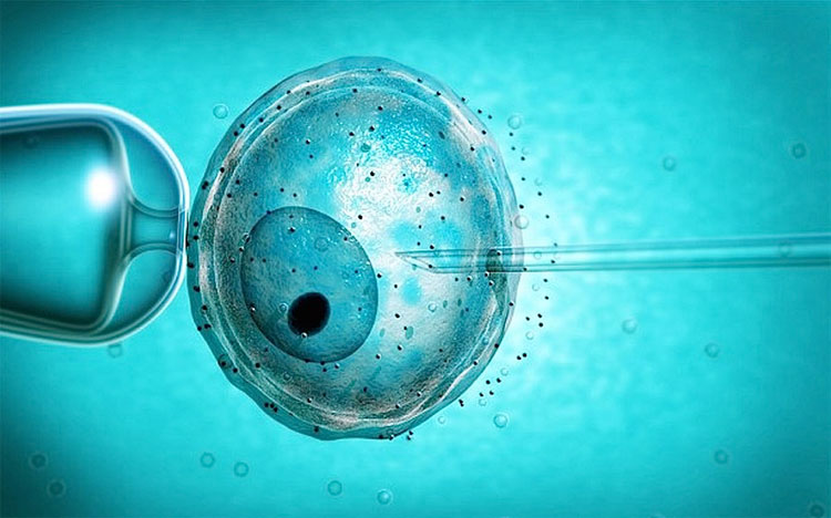 Kỹ thuật ICSI bao gồm việc lựa chọn tinh trùng khỏe mạnh và tiêm nó vào bào tương trứng.