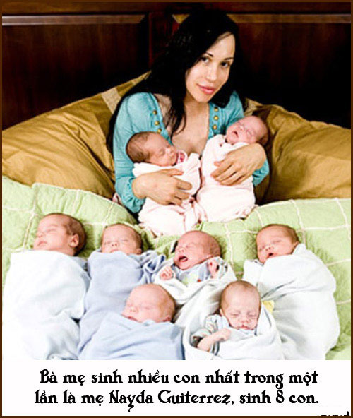 Những chuyện sinh nở đặc biệt không ai có thể 