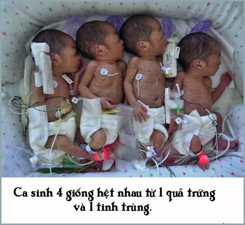 Những chuyện sinh nở đặc biệt không ai có thể 