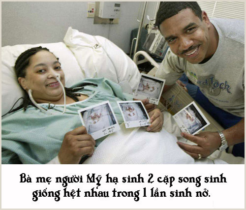Những chuyện sinh nở đặc biệt không ai có thể 