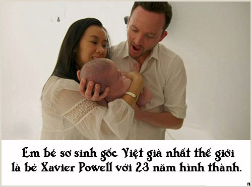 Những chuyện sinh nở đặc biệt không ai có thể 