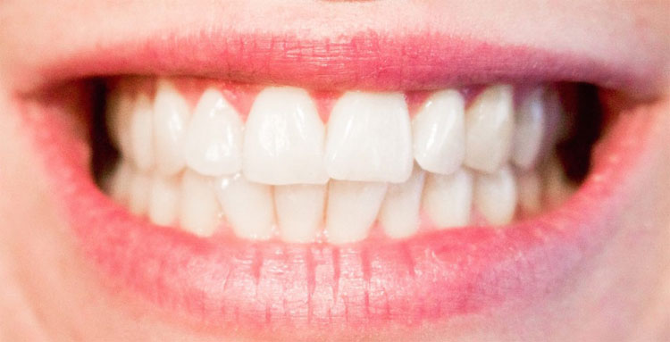 Những con đường dẫn đến cái chết dễ dàng đến không ngờ