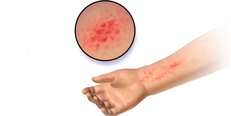 Những con đường dẫn đến cái chết dễ dàng đến không ngờ
