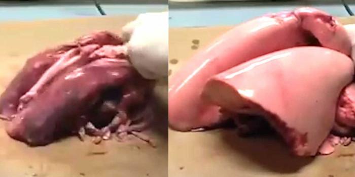 Ví dụ cụ thể về cách phổi giãn nở nhanh chóng khi con người hít một hơi thật sâu.