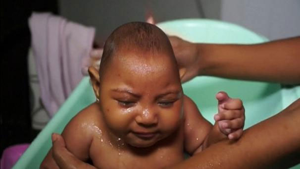 Thắc mắc phổ biến khi virus Zika lan rộng ở Sài Gòn