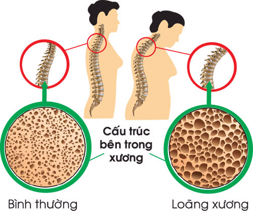 4 dấu hiệu 