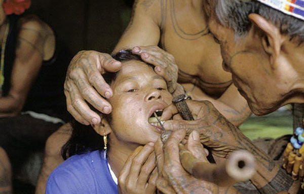 Kỳ dị cách mài răng 
