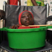 "Cô gái Sọ Dừa" ở Nigeria đã qua đời đúng ngày lễ Giáng sinh