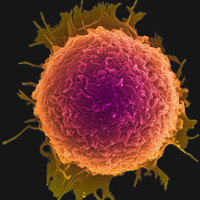 Đĩa nano có thể diệt các tế bào ung thư