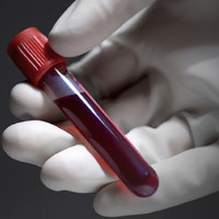 Những điều bác sĩ sẽ không hé lộ trong xét nghiệm máu của bạn