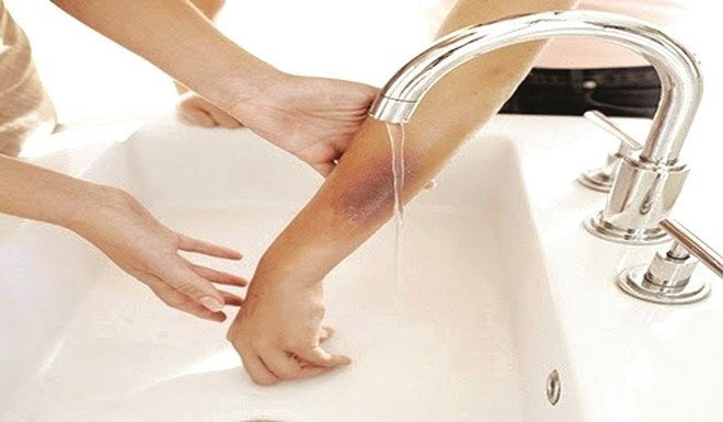 Những loại thuốc nên dự trữ trong nhà dịp Tết
