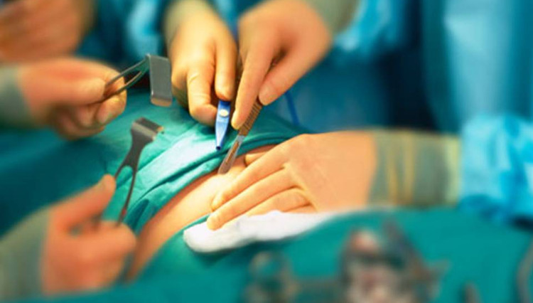 Phẫu thuật thắt dạ dày giúp điều trị bệnh tiểu đường tuýp 2