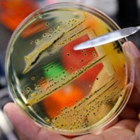 WHO công bố danh sách 12 siêu vi khuẩn đáng lo ngại nhất