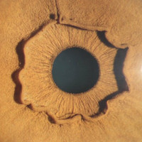 Đây là con mắt của một người, nhưng vì sao lại kỳ dị thế này?