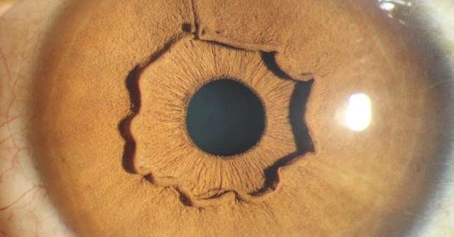 Đây là con mắt của một người, nhưng vì sao lại kỳ dị thế này?