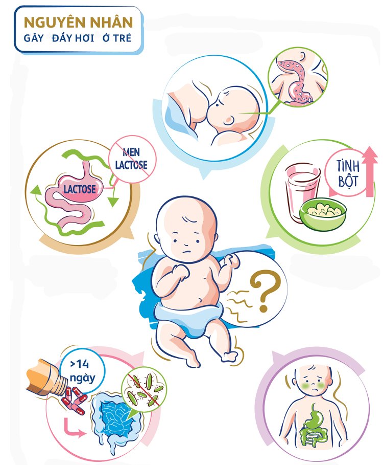 Đầy hơi ở trẻ em và sai lầm cần tránh