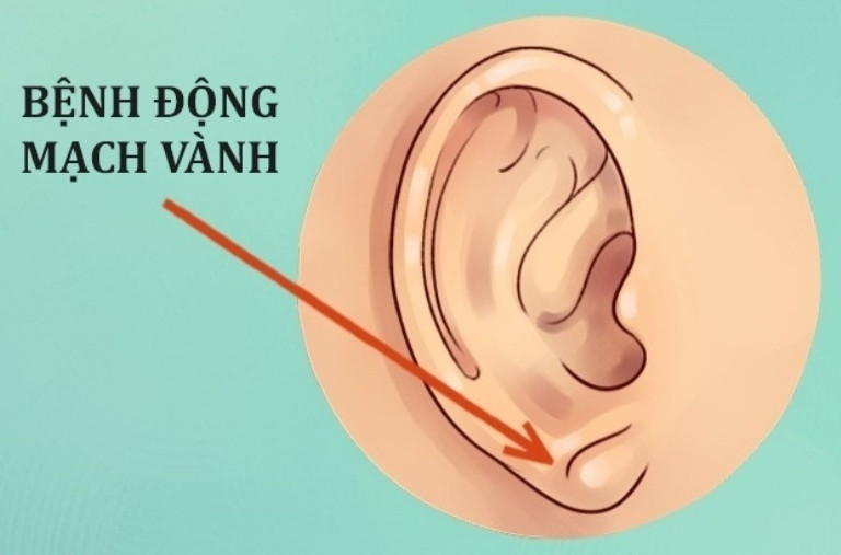Sự thật thú vị về đôi tai hầu hết mọi người không biết