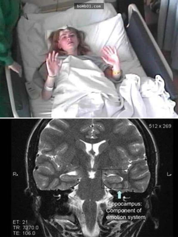 Hệ thống miễn dịch của cơ thể cô bị rối loạn, làm cô "điên điên rồ rồ". Hệ thống miễn dịch của cơ thể cô bị rối loạn, làm cô "điên điên rồ rồ".