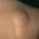 10 dấu hiệu cảnh báo ung thư đang phát triển trong cơ thể ai cũng phải nằm lòng